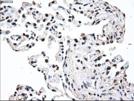 MAP2K2 / MKK2 / MEK2 Antibody (clone OTI8G6)