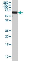 PAPSS2 Antibody (clone 2A8)