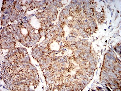 Monoclonal Mouse anti-Human SOD2 / Mn SOD Antibody (clone 8H3F9, IHC, WB)