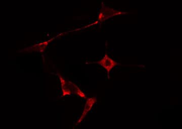 HSPB2 / HSP27 Antibody