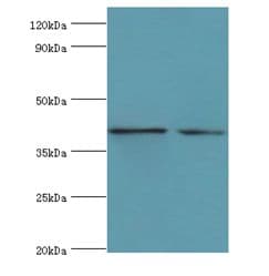 Polyclonal Rabbit anti-Human LGALS9 / Galectin 9 Antibody (aa1-240, IHC, WB)