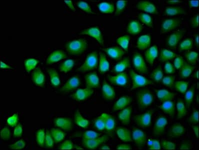 Polyclonal Rabbit anti-Human DVL3 / Dishevelled 3 Antibody (IHC)