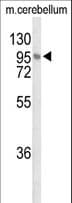 LINGO1 Antibody (aa57-85)
