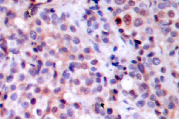 RELA / NFKB p65 Antibody (Thr429)