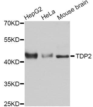 TDP2 / TTRAP Antibody