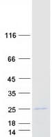 Human EMD / Emerin Protein (Recombinant Myc-DDK (Flag))