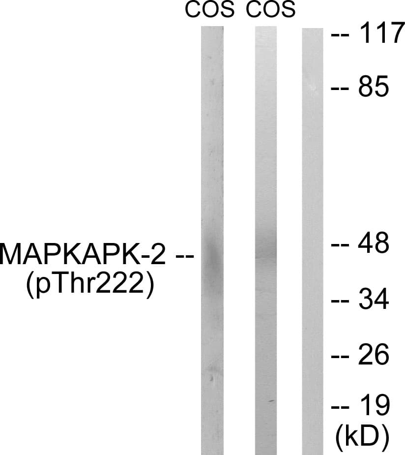 Polyclonal Rabbit anti-Human MAPKAPK2 / MAPKAP Kinase 2 Antibody (phospho-Thr222, IHC, WB)