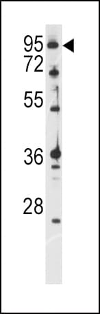 ATXN1 / SCA1 Antibody (Ser776)