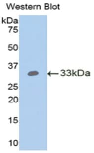 ANGPTL4 Antibody (aa183-401)