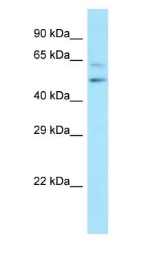 CWC27 Antibody (aa299-348)