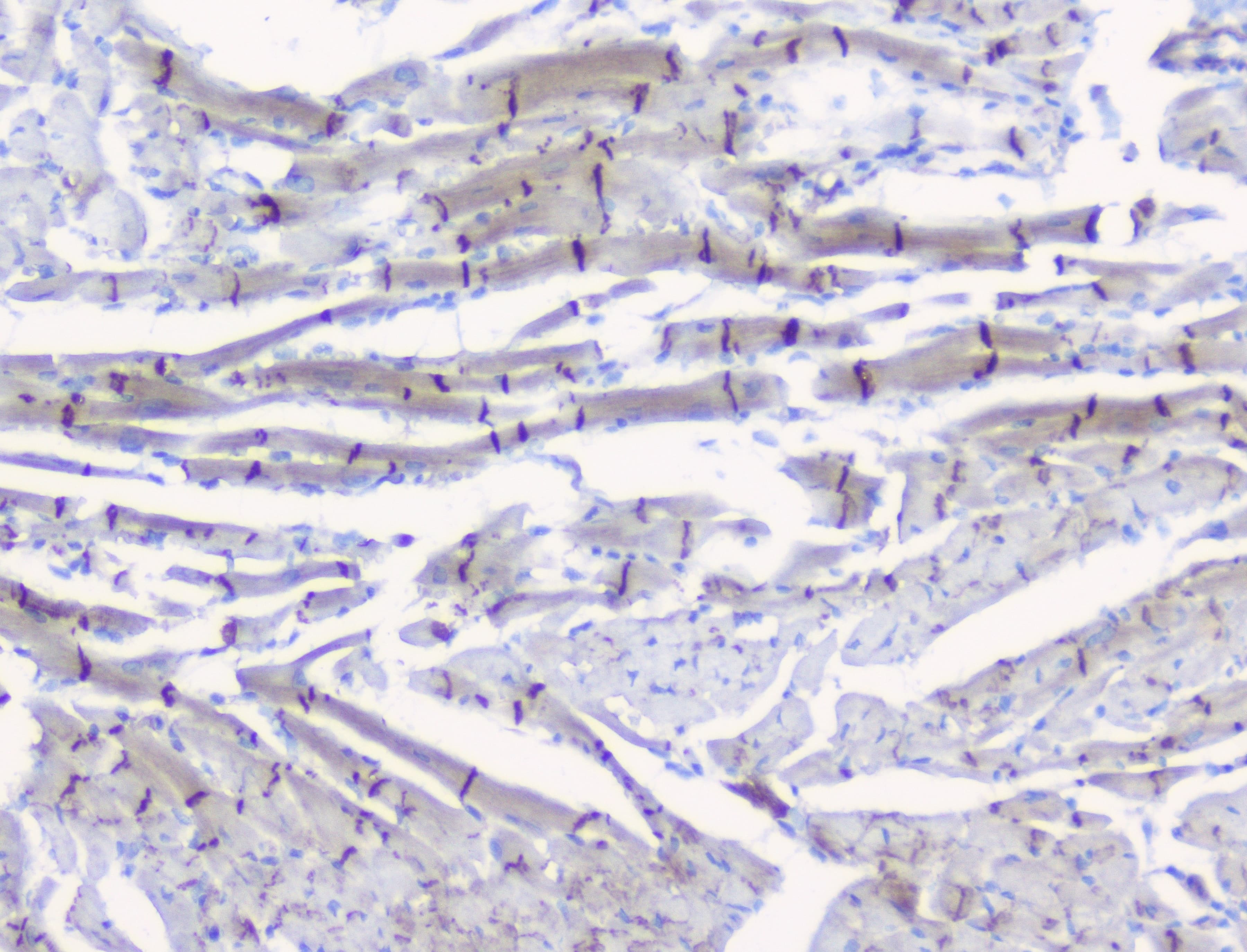 CTNNB1 / Beta Catenin Antibody