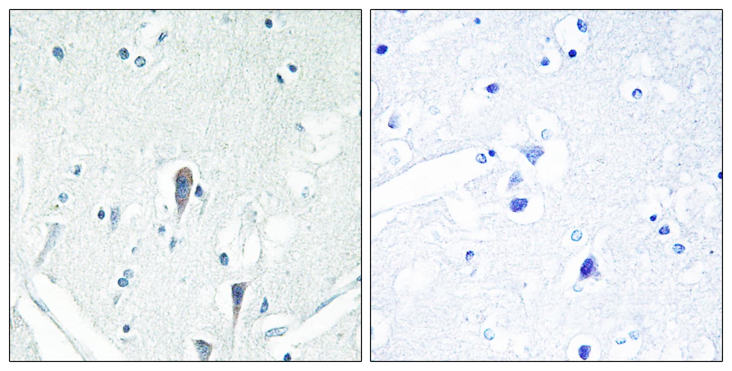 IRAK3 / IRAKM / IRAK-M Antibody (aa491-540)