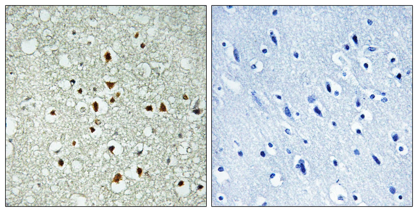 Polyclonal Rabbit anti-Human MAX Antibody (aa1-50, IHC)