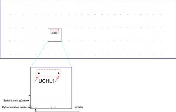 UCHL1 / PGP9.5 Antibody (clone UMAB244)