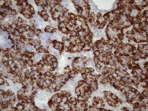 GLYAT Antibody (clone OTI4D1)