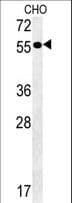 IHC-plus™ AMY2A / Pancreatic Amylase Antibody (aa484-511)