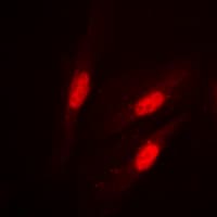 Polyclonal Rabbit anti-Human CTNNB1 / Beta Catenin Antibody (phospho-Ser37, IHC, IF, WB)