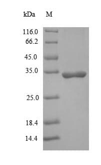 Rhesus monkey IL2 Protein (Recombinant 10His-SUMO, N-terminus + Myc, C-terminus)