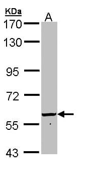 Polyclonal Rabbit anti-Human FTCD / 58K Golgi Protein Antibody (aa1-251, IHC, WB)