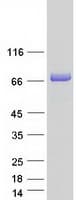 Human FKBP9 Protein (Recombinant Myc-DDK (Flag))