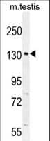 Polyclonal Rabbit anti-Human Capicua / CIC Antibody (aa174-203, IHC, WB)
