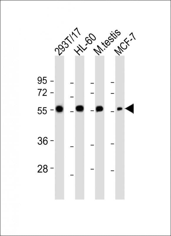Polyclonal Rabbit anti-Human GMCL1 Antibody (aa281-315, IHC, WB)