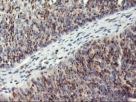 GOLM1 / GP73 / GOLPH2 Antibody (clone OTI2D6)