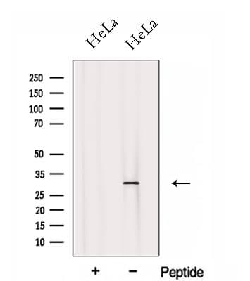 FHL2 Antibody