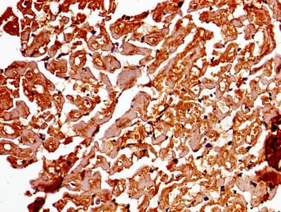ADAMTS4 Antibody