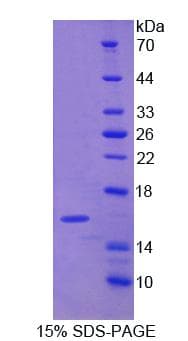 Rat CALD1 / Caldesmon Protein (Recombinant)