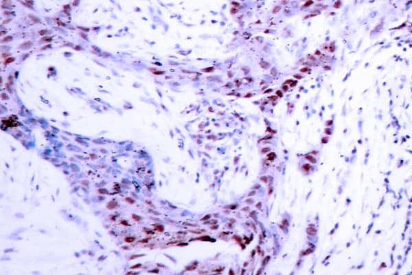 PR / Progesterone Receptor Antibody (phospho-Ser190)