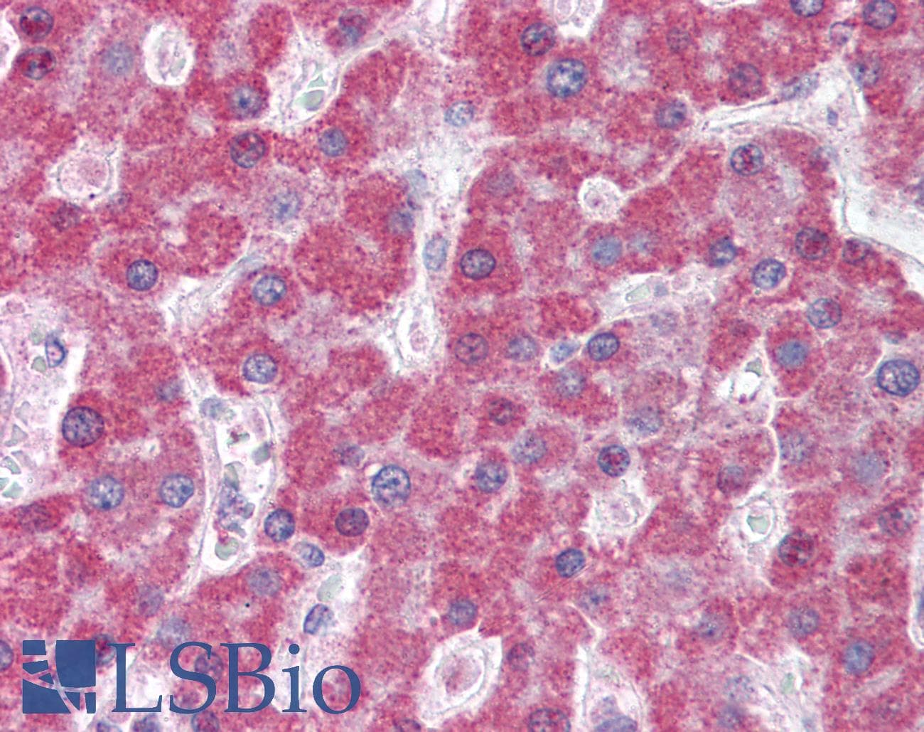 IHC-plus™ ABCC5 / MRP5 Antibody (aa2-13)
