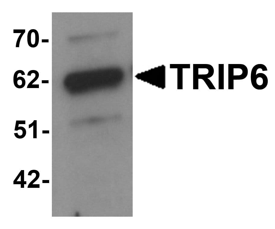 ZRP-1 / TRIP6 Antibody