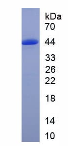 Human DEFB126 Protein (Recombinant His-GST-S)