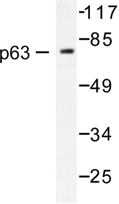 TP63 / p63 Antibody (Asn662)