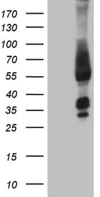 FAM170A Antibody (clone OTI4C6)