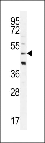 CRHR2 / CRF2 Receptor Antibody