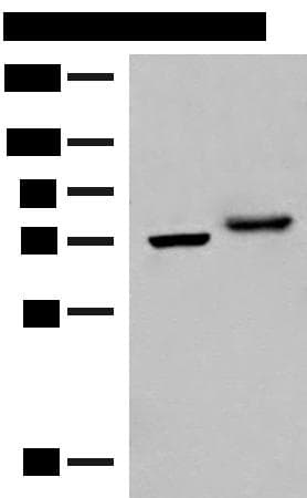 POMGNT1 Antibody