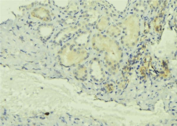 ClC-5 / CLCN5 Antibody
