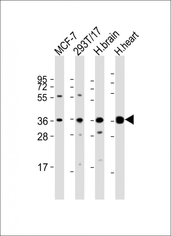 Polyclonal Rabbit anti-Human BRCC3 / BRCC36 Antibody (aa18-50, WB)