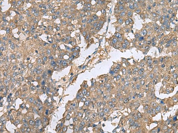 Polyclonal Rabbit anti-Human EIF1AX Antibody (IHC)