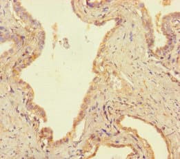 USP14 Antibody