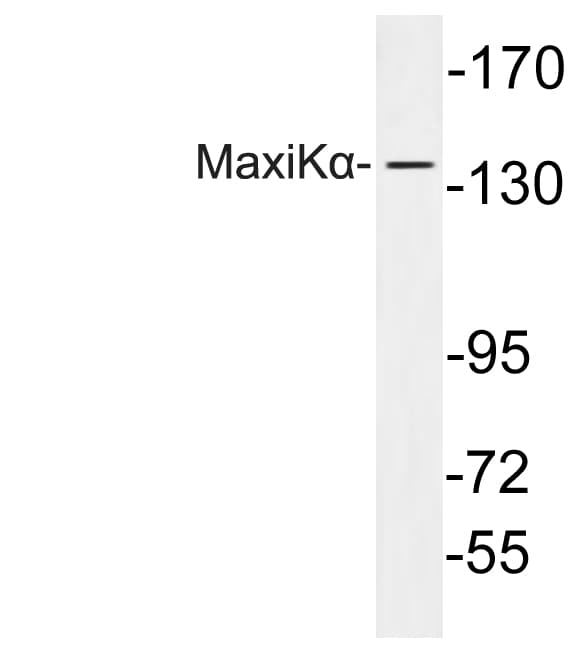 KCNMA1 / BK Antibody (aa721-770)