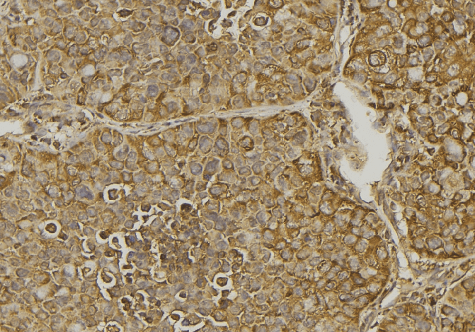 Polyclonal Rabbit anti-Human CXCL11 Antibody (IHC, WB)