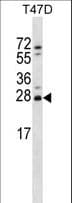 ZMAT2 Antibody (aa154-182)