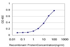 F13A1 / Factor XIIIa Antibody (clone M1)