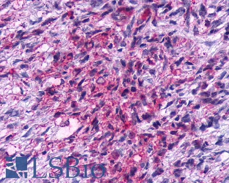 PathPlus™ KISS1R / GPR54 Antibody (Cytoplasmic Domain)