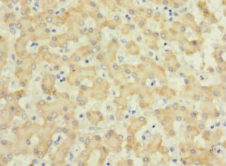 IL17RB Antibody