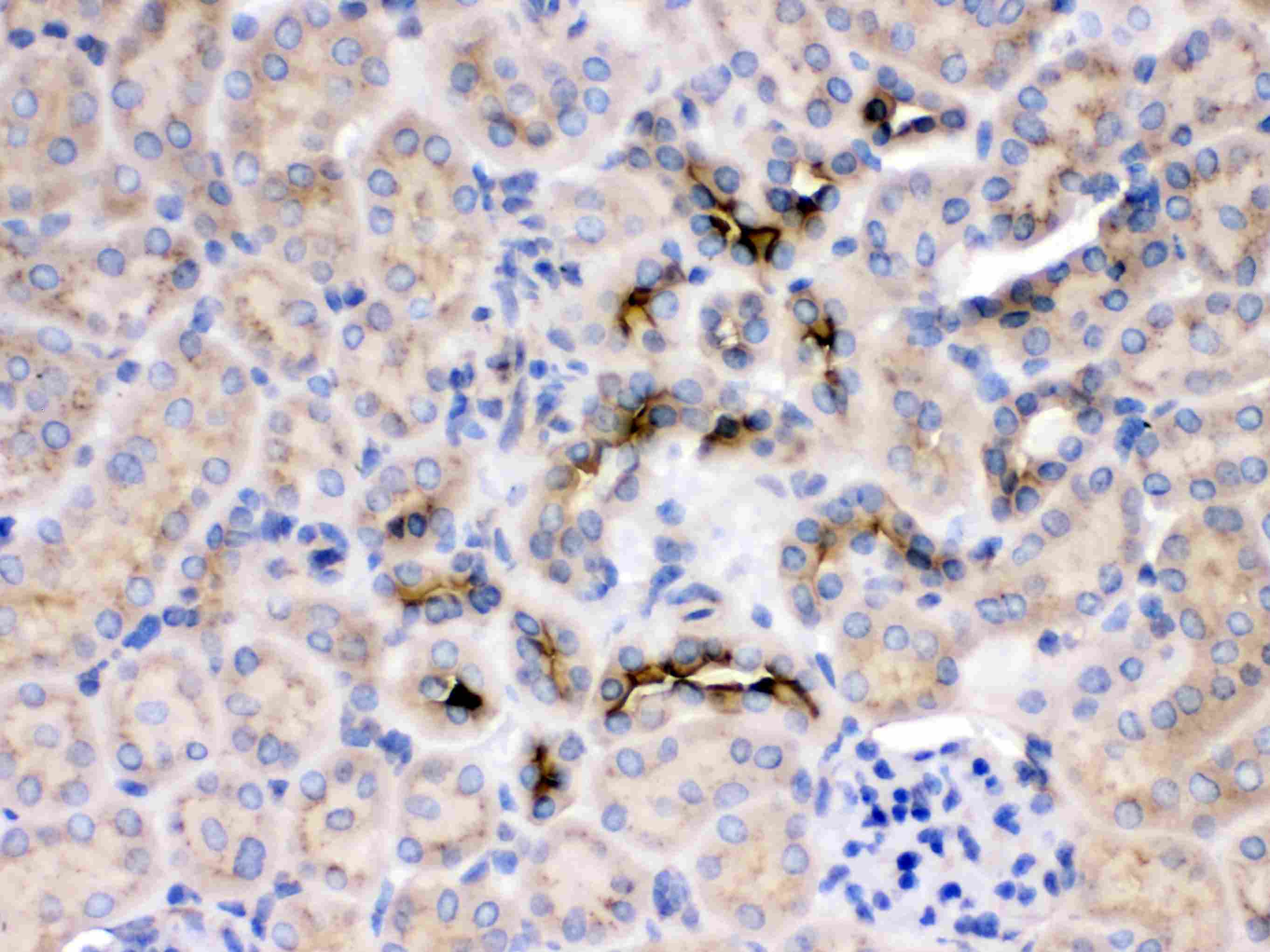 Polyclonal Rabbit anti-Human GNB1 Antibody (IHC, WB)