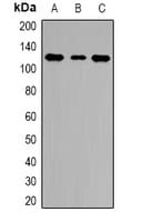SMARCA3 / HLTF Antibody